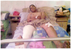 (مصلح) طريح الفراش والجاني خدع العدالة 1 03 03 13 441055266