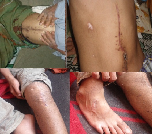 دكتور بمستشفى الصفوة يحول جريح من الساحة إلى طبيب نفسي 1 05 06 12 860047871