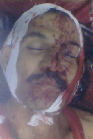 تعز.. العثور على جثة في التحرير ومقتل مواطن في قراضة ونهب سيارة وسط المدينة 1 05 08 13 87522751