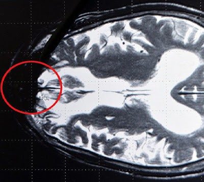 اكتشاف "وكر الشيطان" 1 09 04 13 257261086