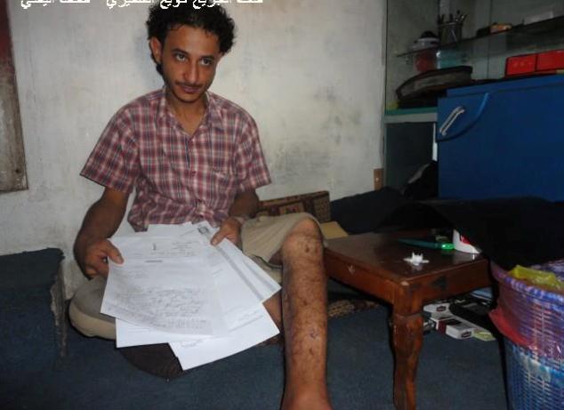 (فيديو) جريح مجزرة بصنعاء يوجه رسالة لتوكل كرمان ويحملها مسؤلية حياته 1 10 06 12 474534598