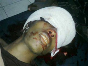 مصرع شاب برصاص قوات الأمن بمحافظة عدن 1 15 05 13 95739015