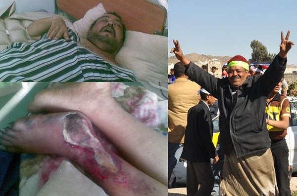 وفاة جريح الثورة عبد الرحمن الكمالي متأثرا بجراحه في القاهرة وفريق قانوني يدرس مقاضاة الحكومة وقوات الأمن الخاص لتسببهم في وفاته 1 19 07 13 246374775