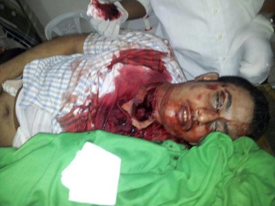 المكلا : قتيل واربعة جرحى برصاص الامن بجانب قصر بقشان بخلف 1 22 03 13 49969461