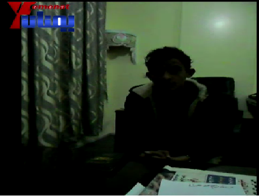 "فيديو" جريح الثورة فاروق عبد الله سعيد يشرح رحلة معاناة بين اليمن وتركيا تكشف زيف جمعيات خيرية تدعى رعاية الجرحى 1 27 01 13 729954625