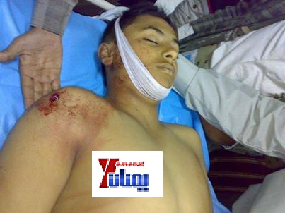 مقتل طفل في حجة وهو يرتدي الزي المدرسي أثر خلاف بين قبيلتين على قطعة أرض 1 28 06 13 531830498