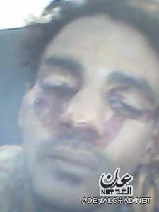 عدن:جماعة مسلحة تقتل شاب بدار سعد وتقول ان السبب ( سب الرب) 1 28 12 12 656653161