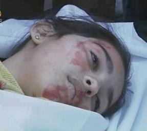 قوات الجيش تقتل فتاة قامت بإبداء رأسها من نافذة منزلها في لحج