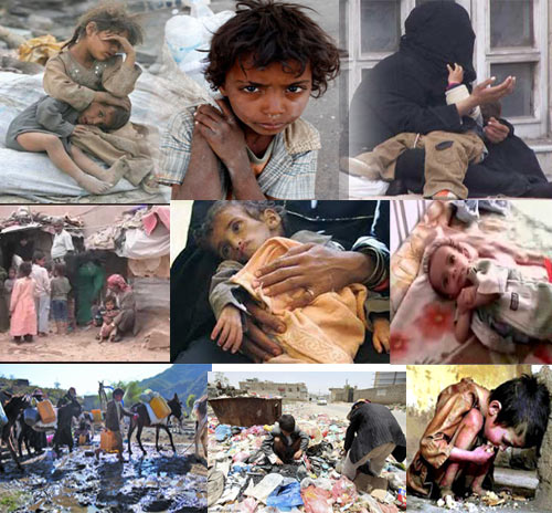 مشكلة الأمن الغذائي في اليمن في ازدياد مستمر