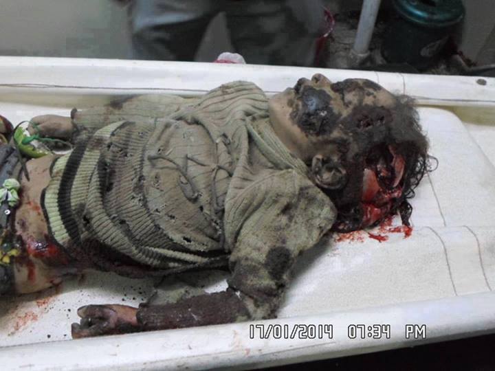 مقتل طفله في الرابعة من عمرها في منطقة السلخانة بالحديدة