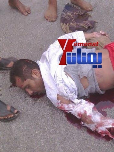 وفاة وإصابة أكثر من 20 شخصا بحوادث متفرقة أمس