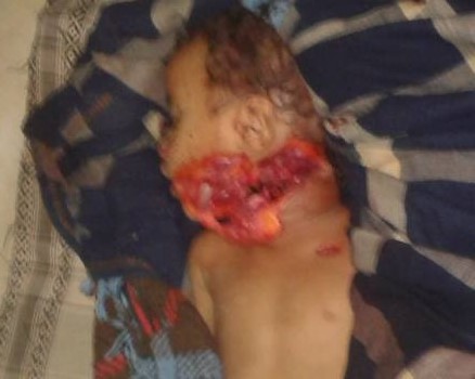 مصرع شخص ذبحا بساطور على يد جيرانه بجعار أبين