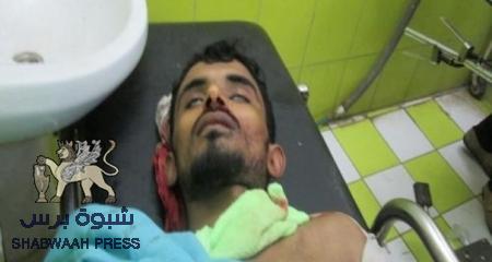 مقتل شاب برصاص قوات الأمن أثناء تفريقها تظاهرة في عدن