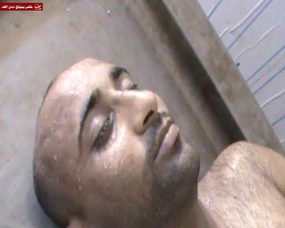 وفاة شاب متأثرا بطلقات نارية لمسلحين مجهولين في لحج