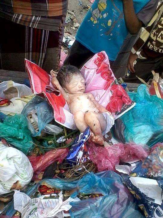 العثور على طفلة حديثة الولادة بين أكوام القمامة غرب مدينة تعز