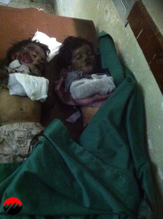 توفي أربعة أطفال من أسرة واحدة في تعز