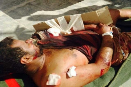 جرحى في الهجوم على نقطة عسكرية غرب مدينة شبام