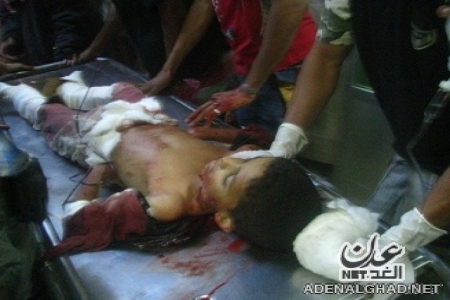 مصرع طفل واصابة اثنين آخرين بانفجار قنبلة بمركز جماعة دينية