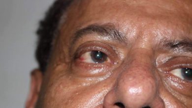 احمد سيف حاشد،