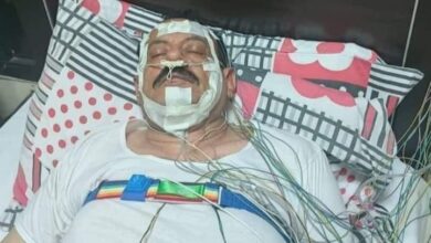 حاشد في العناية القاهرة