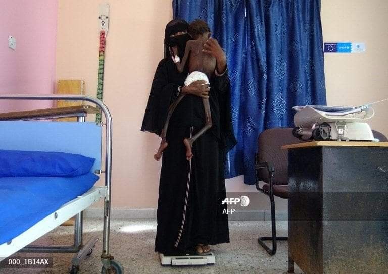 برنامج الاغذية العالمي يُوقف أحد برامجه في مناطق سلطة صنعاء 1 6753321353 2