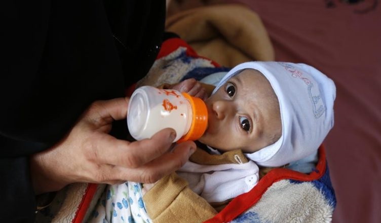 "أطباء بلا حدود" تحذر من تصاعد سوء التغذية الحاد بين أطفال اليمن 1 6753321353 3