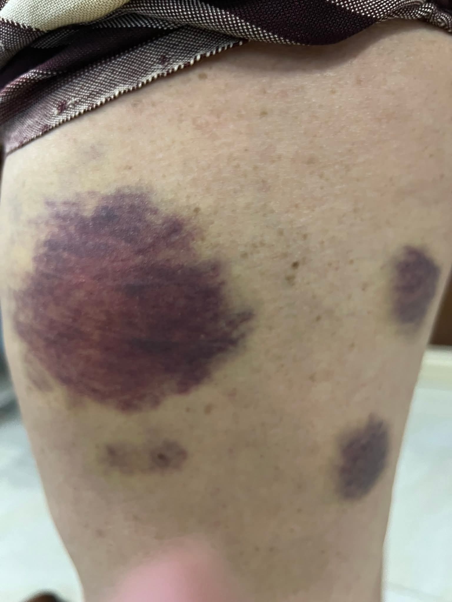 تغاريد حرة .. قل ما تريد ونحن نقطقط ما نريد 17 FB IMG 1762579659139